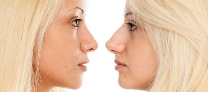 Plastic Surgery- What Is The Best Age To Have It?