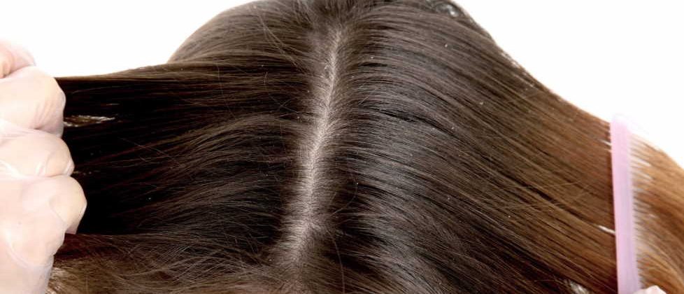 Different Cause Of Dry Scalp You Should Know About